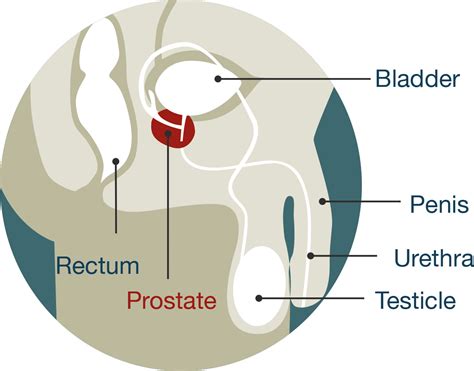 prostatexxx